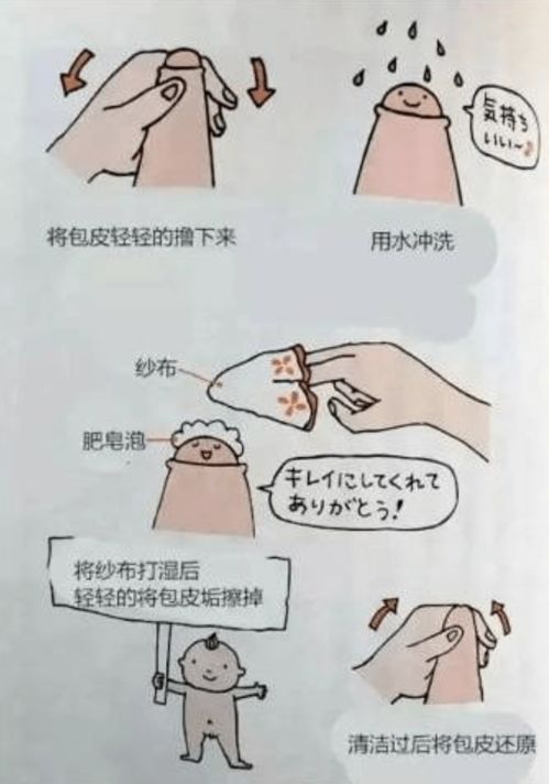 男生割包皮后注意事项
