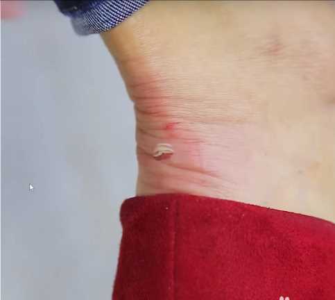 鞋子磨脚后跟要怎么处理鞋子