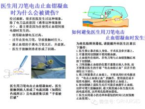 手术室护理安全知识