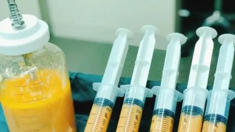 抽脂肪20斤一般多少钱