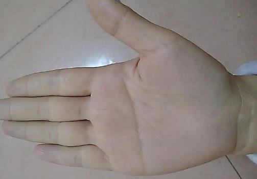 断掌纹的女人