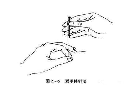 2双手进针有哪些方法
