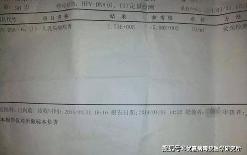 hp18阳性的治疗方法有哪些