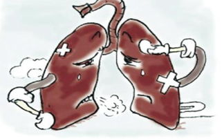 肺癌主要检查方法有哪些