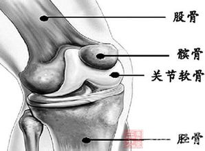 退行性骨关节炎的治疗方法有哪些