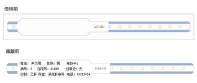 常用识别患者身份的方法有哪些