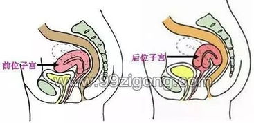 子宫肌瘤止血方法有哪些