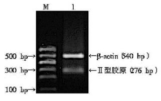 提取动物rna的方法有哪些