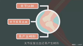血友病的最新治疗方法有哪些