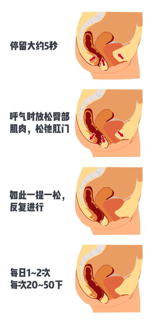 顽固性便秘的诊断方法有哪些