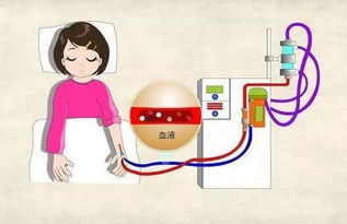 肌酐高的中医治疗方法有哪些