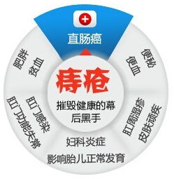 快速治疗痔疮小方法有哪些方法