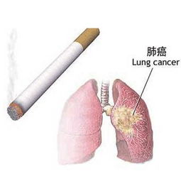 治肺癌药物有哪些方法有哪些方法