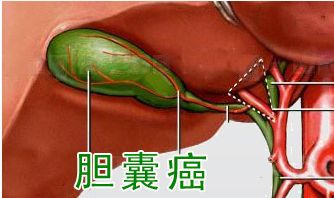 关于胆的检查有哪些方法