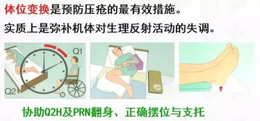 压疮的护理(压疮护理论文)