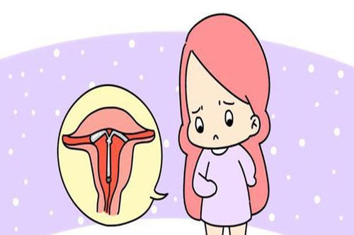女人装环后注意事项