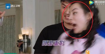注意事项,护士服