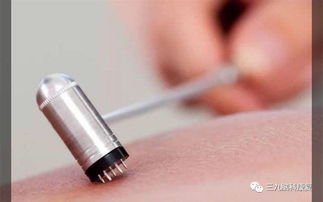 刺络注意事项