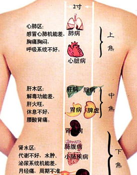 背部刮痧后要注意事项