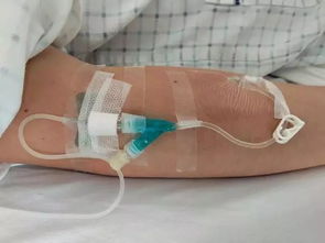 静脉输液法的注意事项