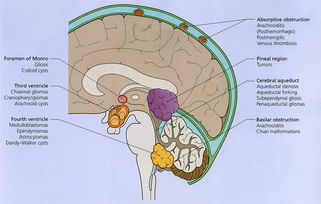 脑水肿观察的注意事项