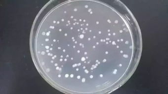 蜡质芽孢杆菌注意事项,使用芽孢杆菌的注意事项,地衣芽孢杆菌注意事项