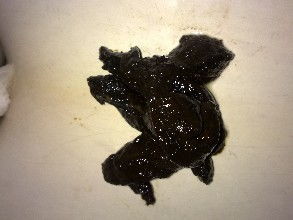 大便黑色注意事项