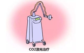 尖锐湿疣激光治疗后注意事项