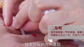 验光,注意事项