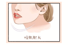 微整形术后注意事项