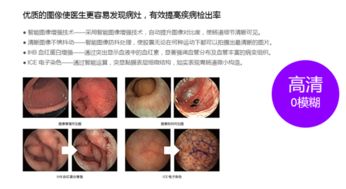 做胃镜前注意事项m.baidu.com