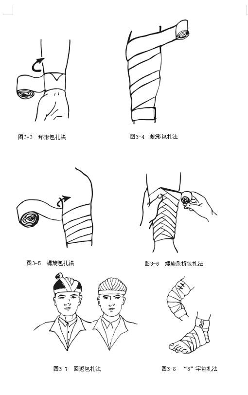 绷带包扎的基本方法及注意事项