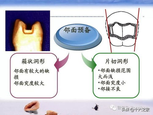 适应症,临床,注意事项
