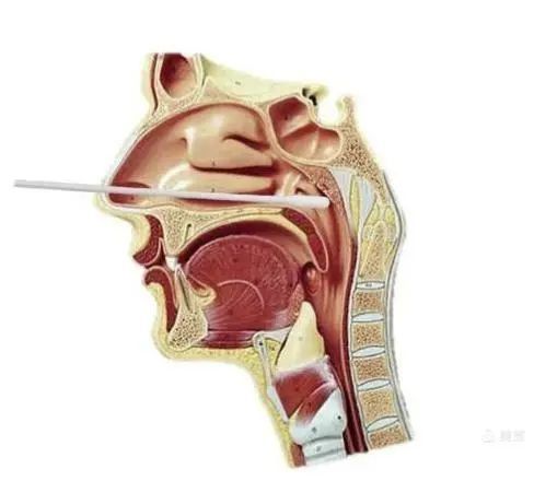 口咽拭子采集部位正确图片
