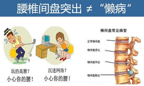 腰椎盘凸出手术,腰椎盘凸出治疗,腰椎盘微创手术后注意事项