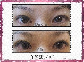 睫毛,注意事项