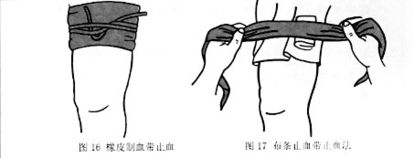 加压包扎止血的注意事项
