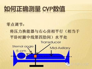 简述测量cvp的注意事项,测量CVP的注意事项,CVP注意事项