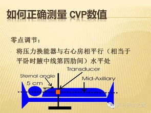 简述测量cvp的注意事项,测量CVP的注意事项,CVP注意事项