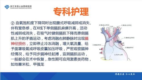 导管消融术后注意事项