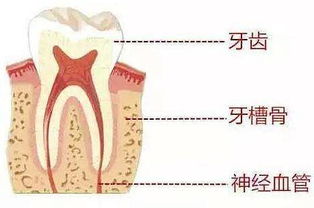 牙槽骨切除术注意事项