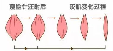 第一次打针注意事项