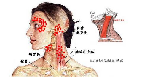 颈椎做完正骨手法后注意事项