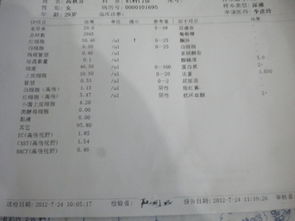 偏高,注意事项,饮食,尿素氮