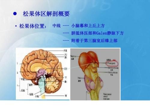 松果体囊肿注意事项,儿童松果体钙化,松果体肿瘤饮食注意事项