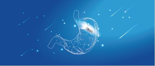 做胃部彩超注意事项