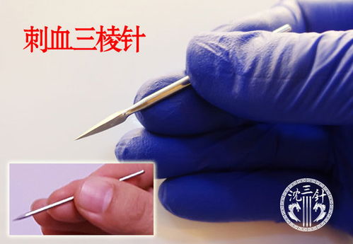 舌根放血后注意事项,放血后注意事项不能吃,针灸放血后注意事项