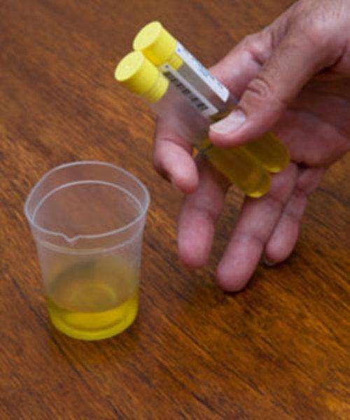 尿标本收集注意事项