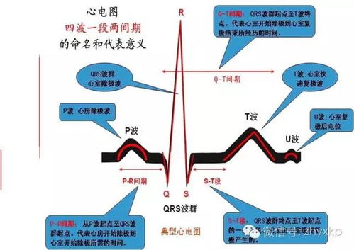 心电图,测量,注意事项