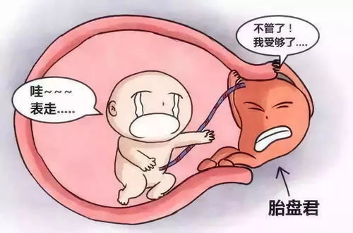 32周胎盘前置注意事项